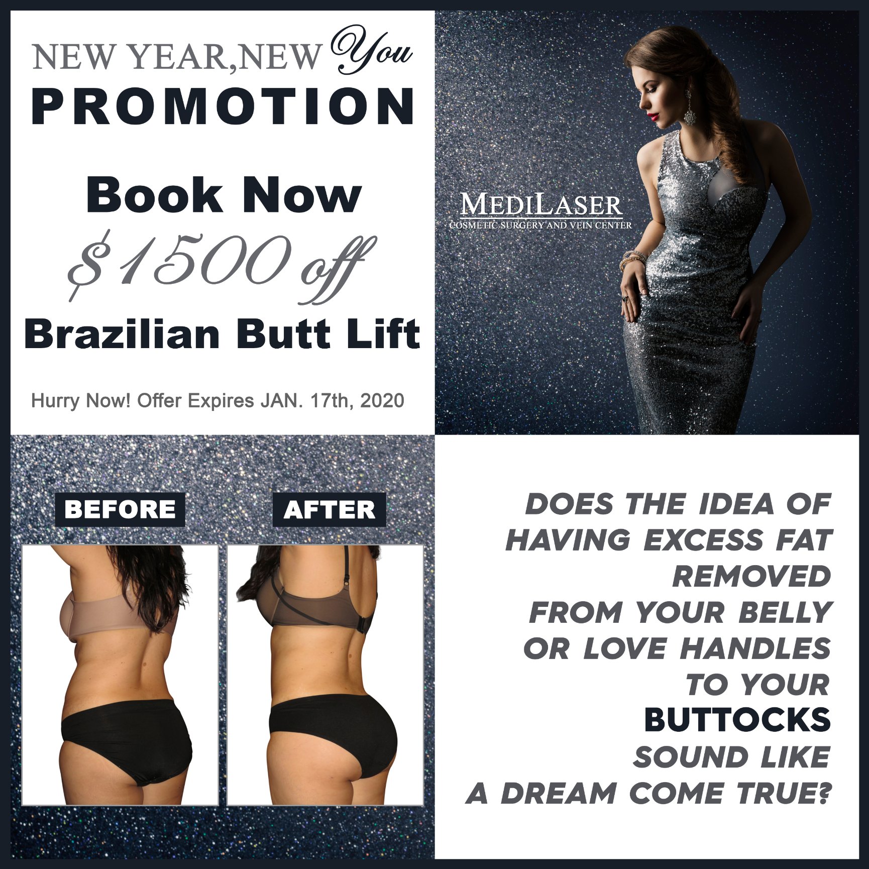 Brazilian Butt Lift BBL Before and After - Medilaser Surgery and Vein Center