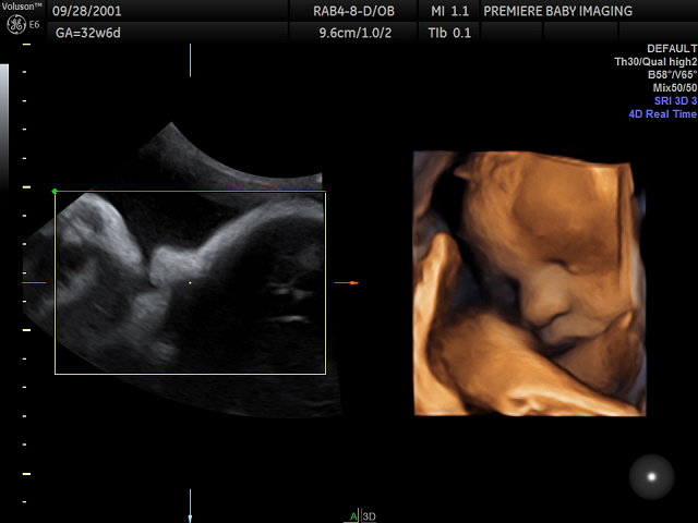 3D 4D Ultrasound Sherman TX Durant Oklahoma Premiere Baby Imaging