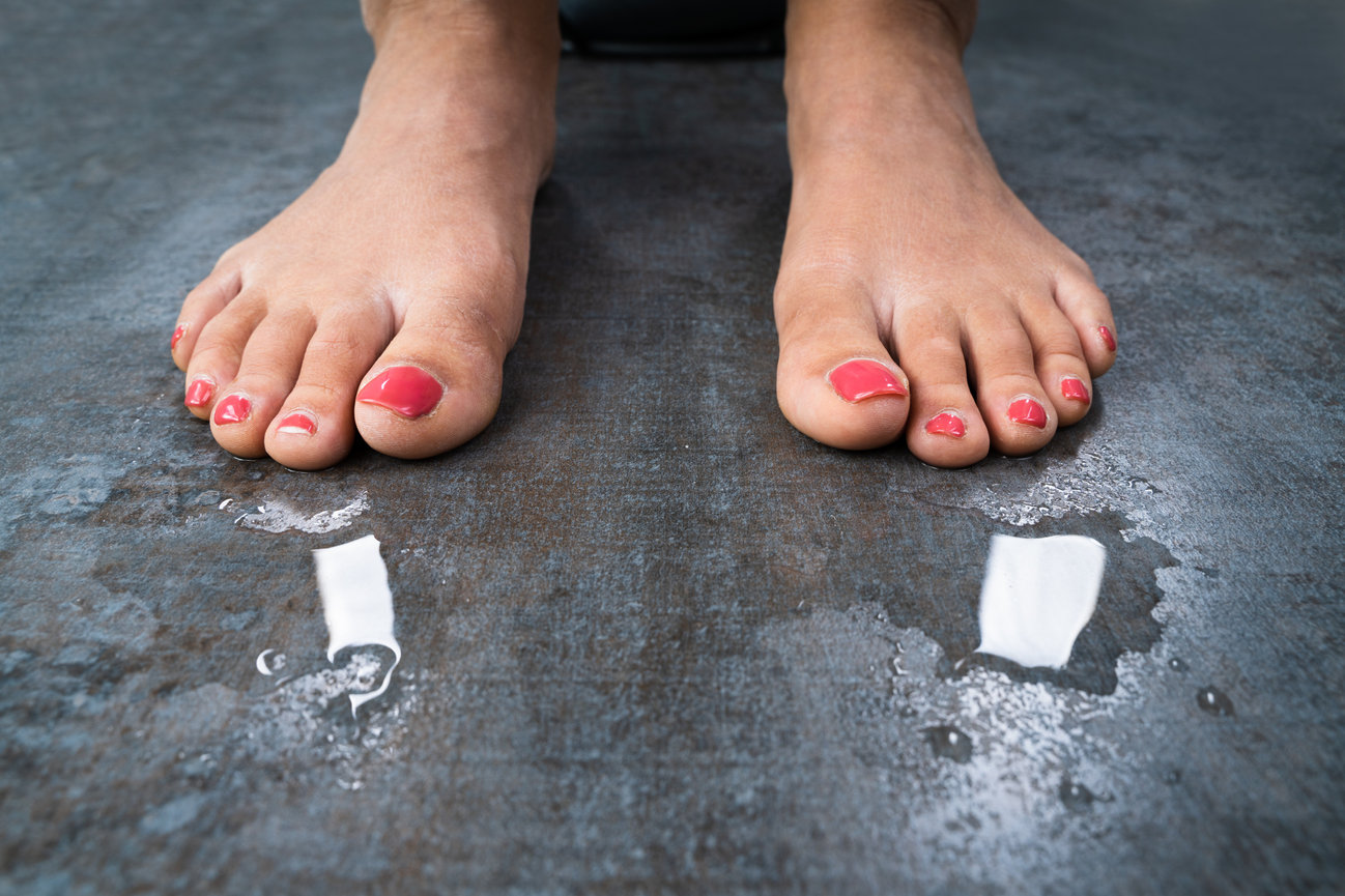 Hyperhidrosis Foot & Ankle Centers of Frisco and Plano