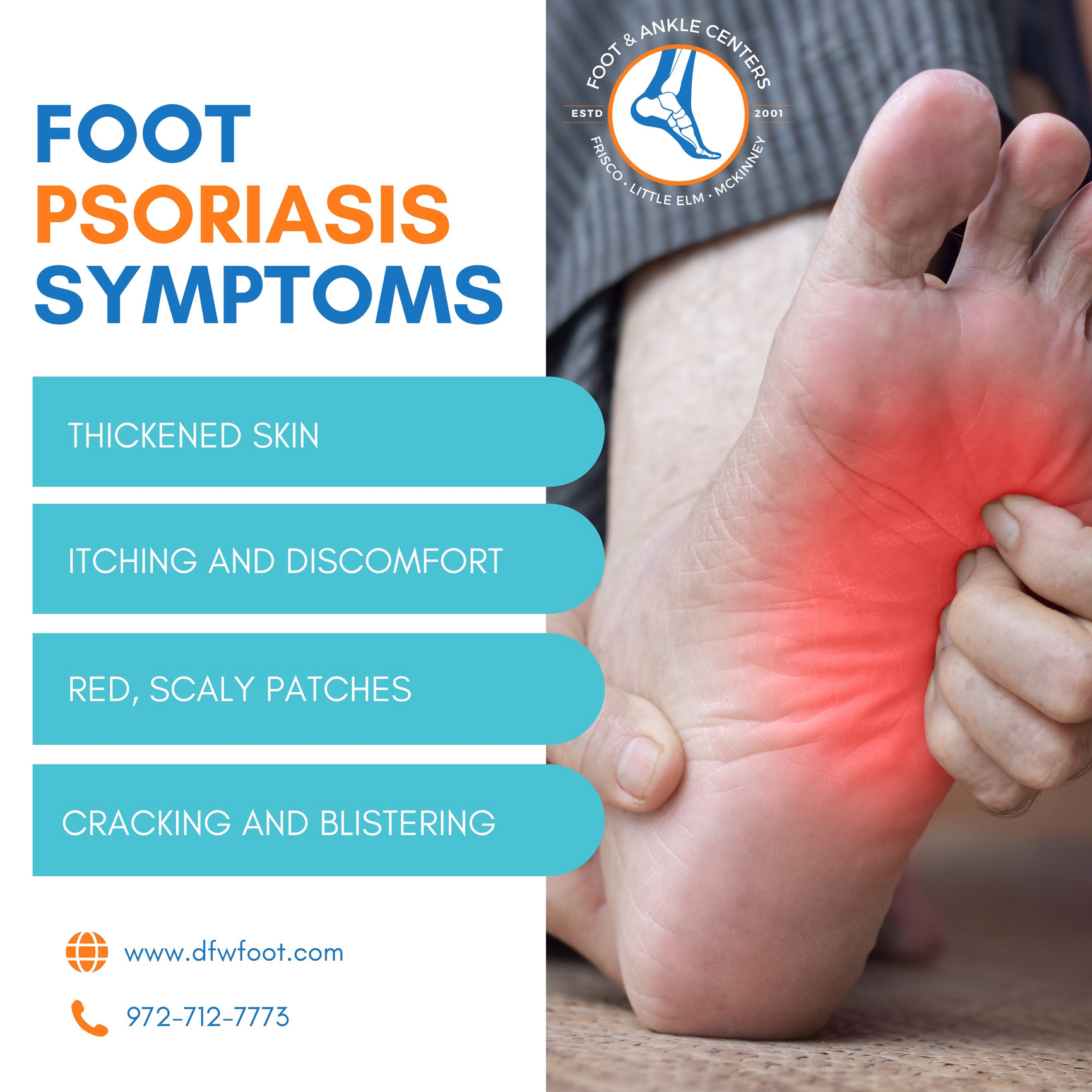 Foot psoriasis symptoms in Frisco, Little Elm, and McKinney - Foot ...